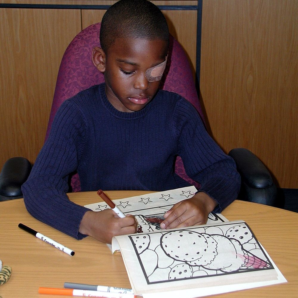 Photo of a child with amblyopia (lazy eye, aalsi aankh) wearing an eye patch over the stronger eye while drawing